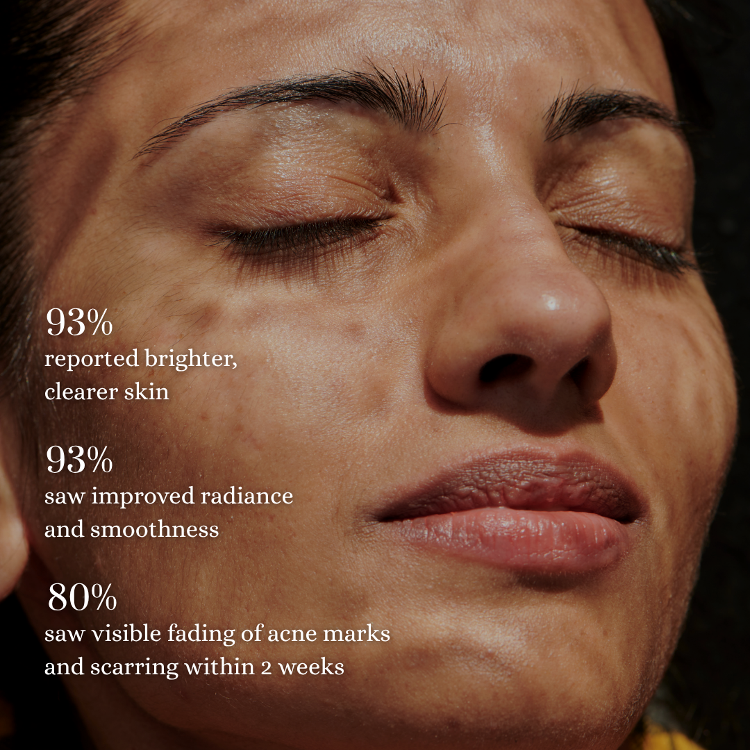 The Blemish Control Set